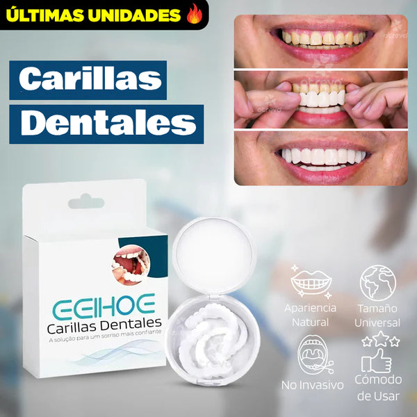 SmileFit® - Carillas Dentales Naturales Removibles